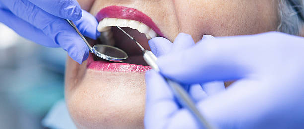 Best Emergency Dentist for Knocked-Out Tooth in Village Of Four Seasons, MO